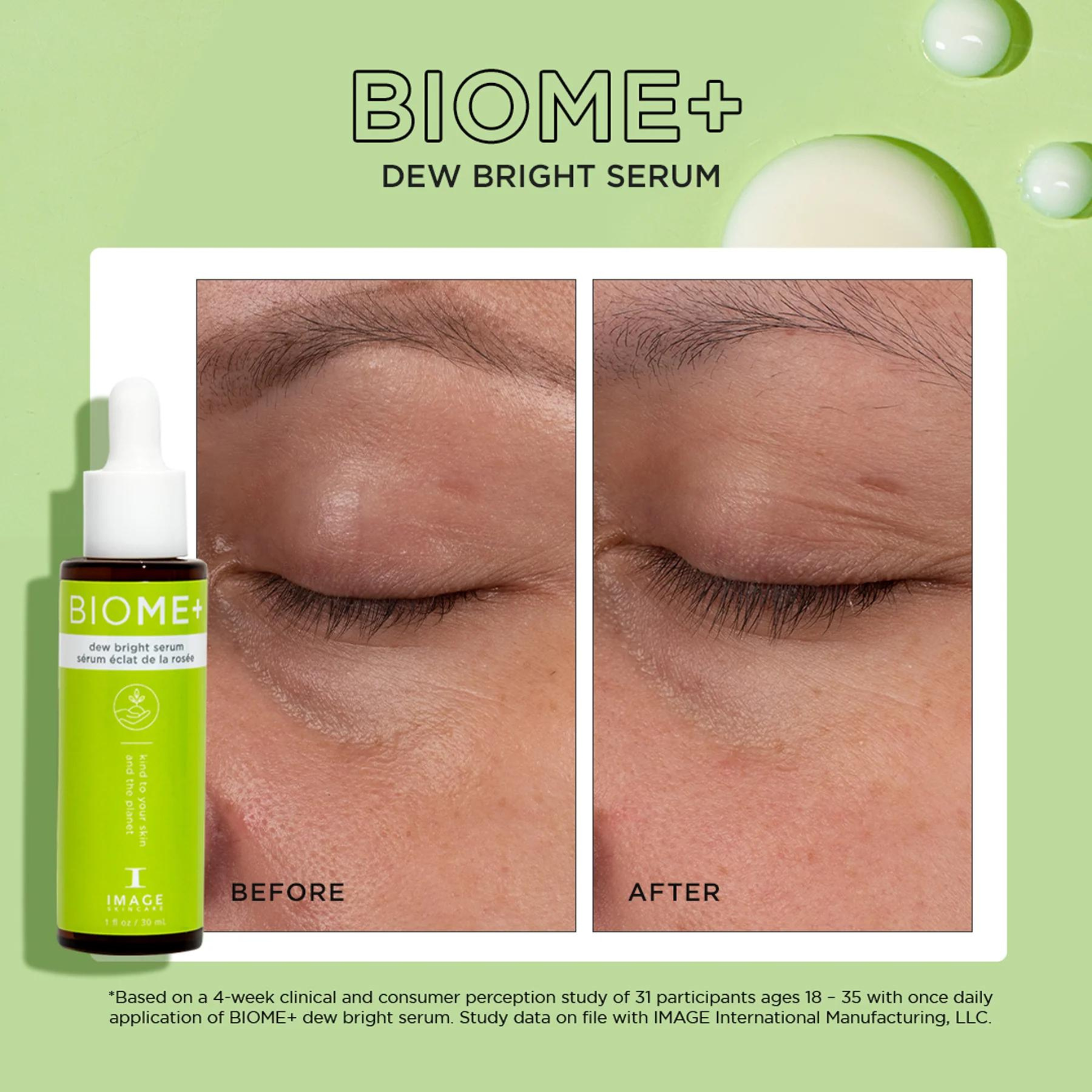 BIOME+™ Dew Bright Serum | IMAGE Skincare