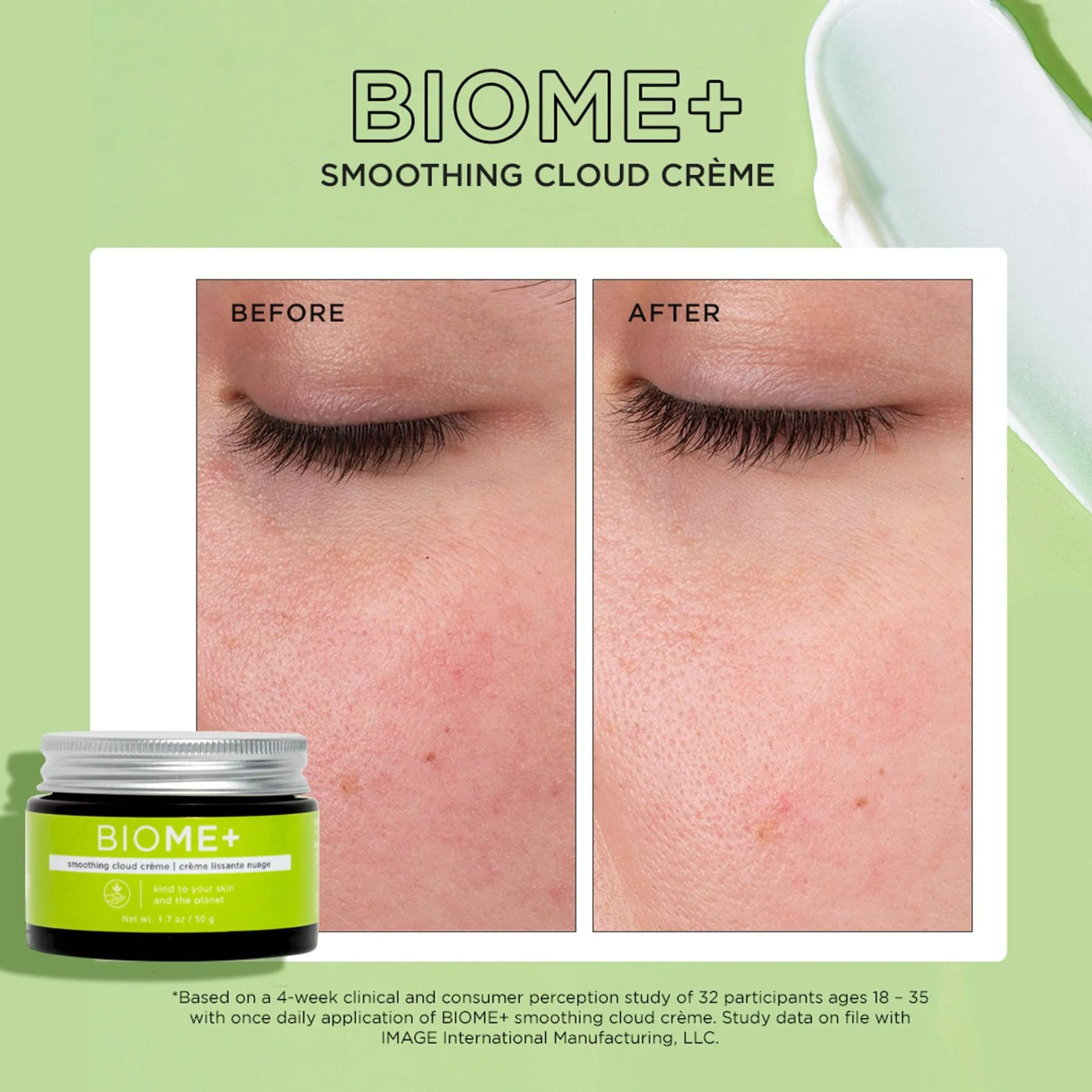 BIOME+™ Smoothing Cloud Creme | IMAGE Skincare