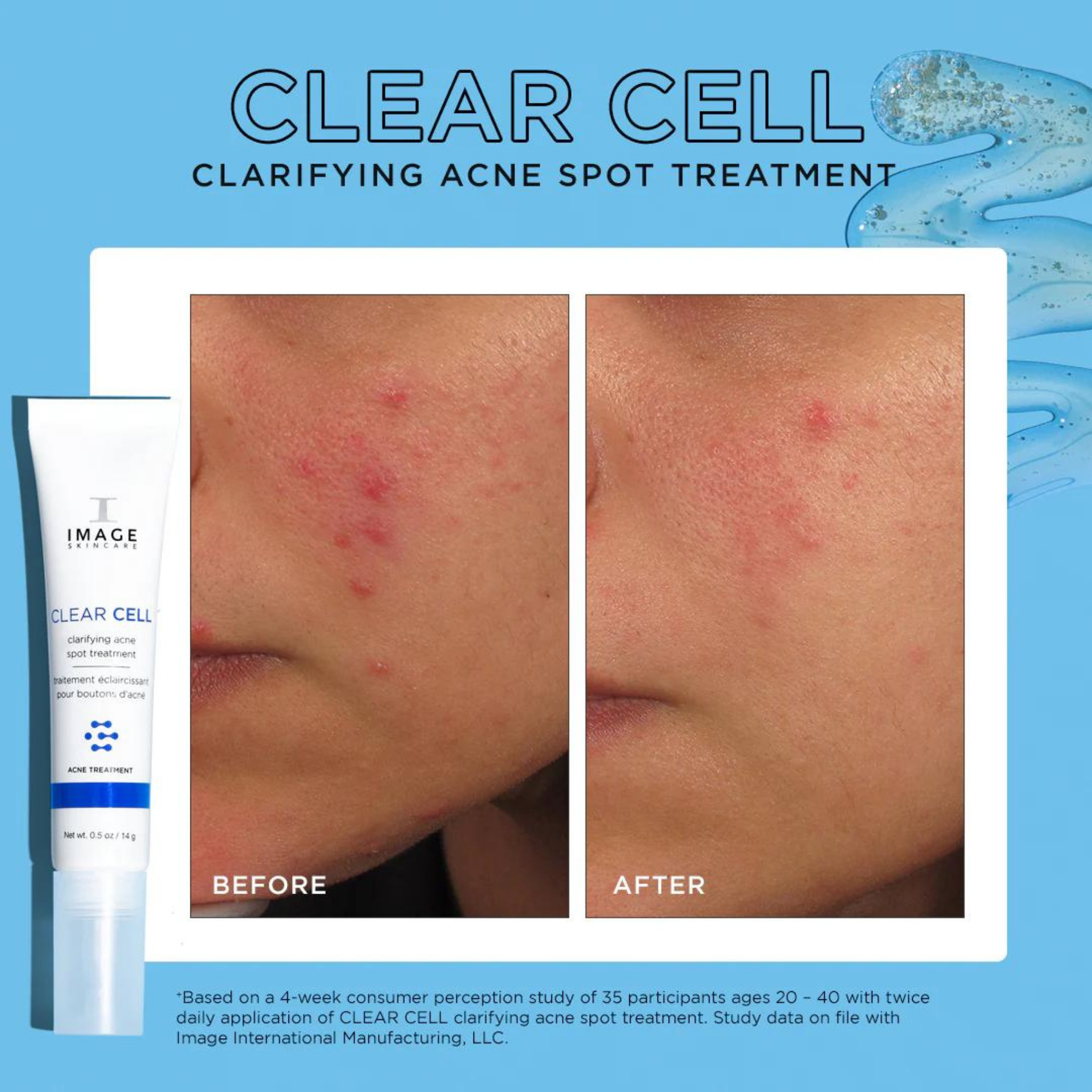 CLEAR CELL Clarifying Acne Spot Treatment | IMAGE Skincare