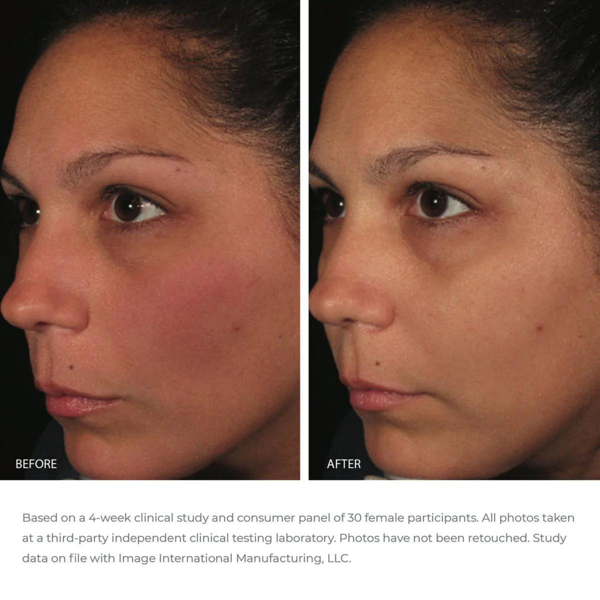 ORMEDIC® Balancing Antioxidant Serum | IMAGE Skincare