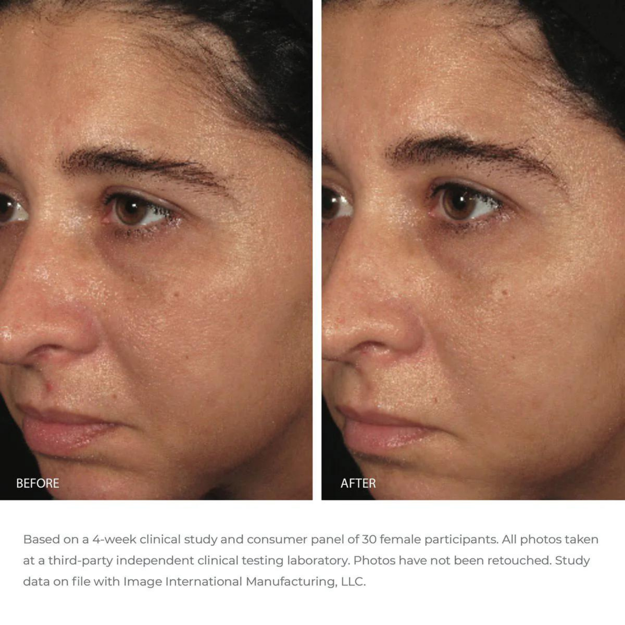 ORMEDIC® Balancing BioPeptide Creme | IMAGE Skincare
