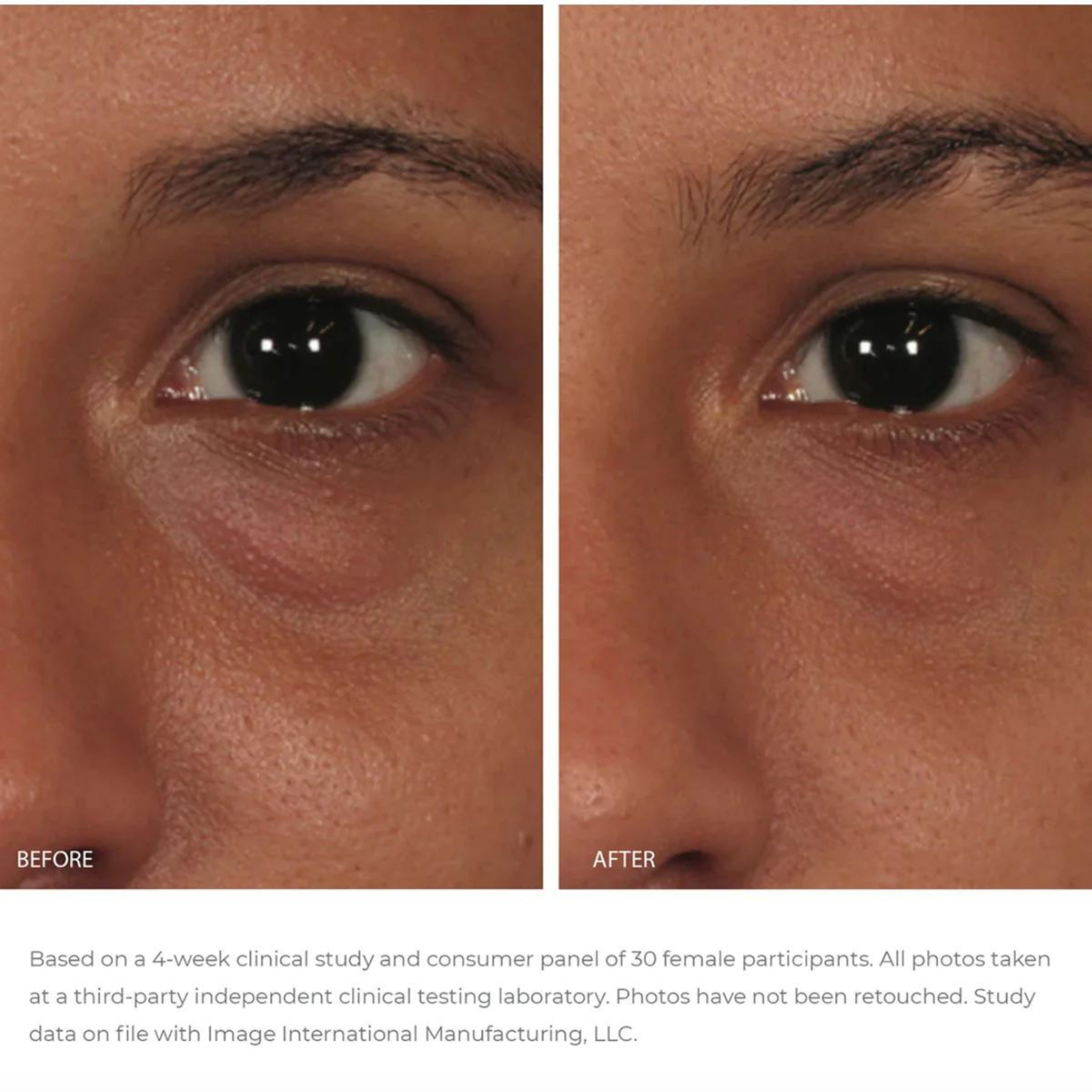 ORMEDIC® Balancing Eye Lift Gel | IMAGE Skincare