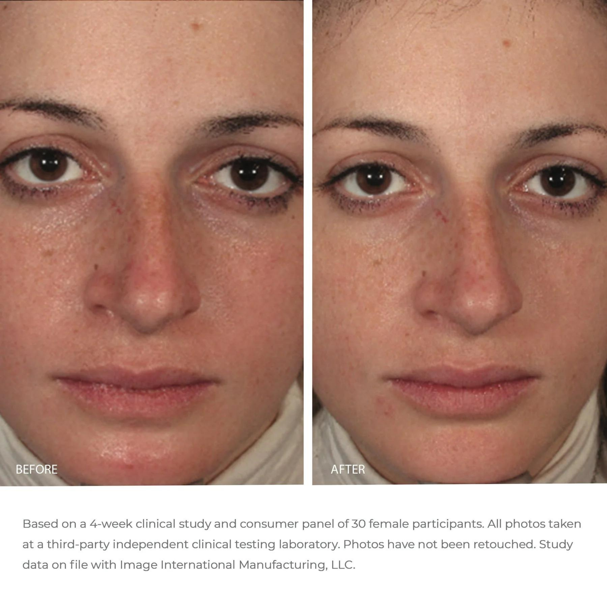 ORMEDIC® Balancing Gel Masque | IMAGE Skincare