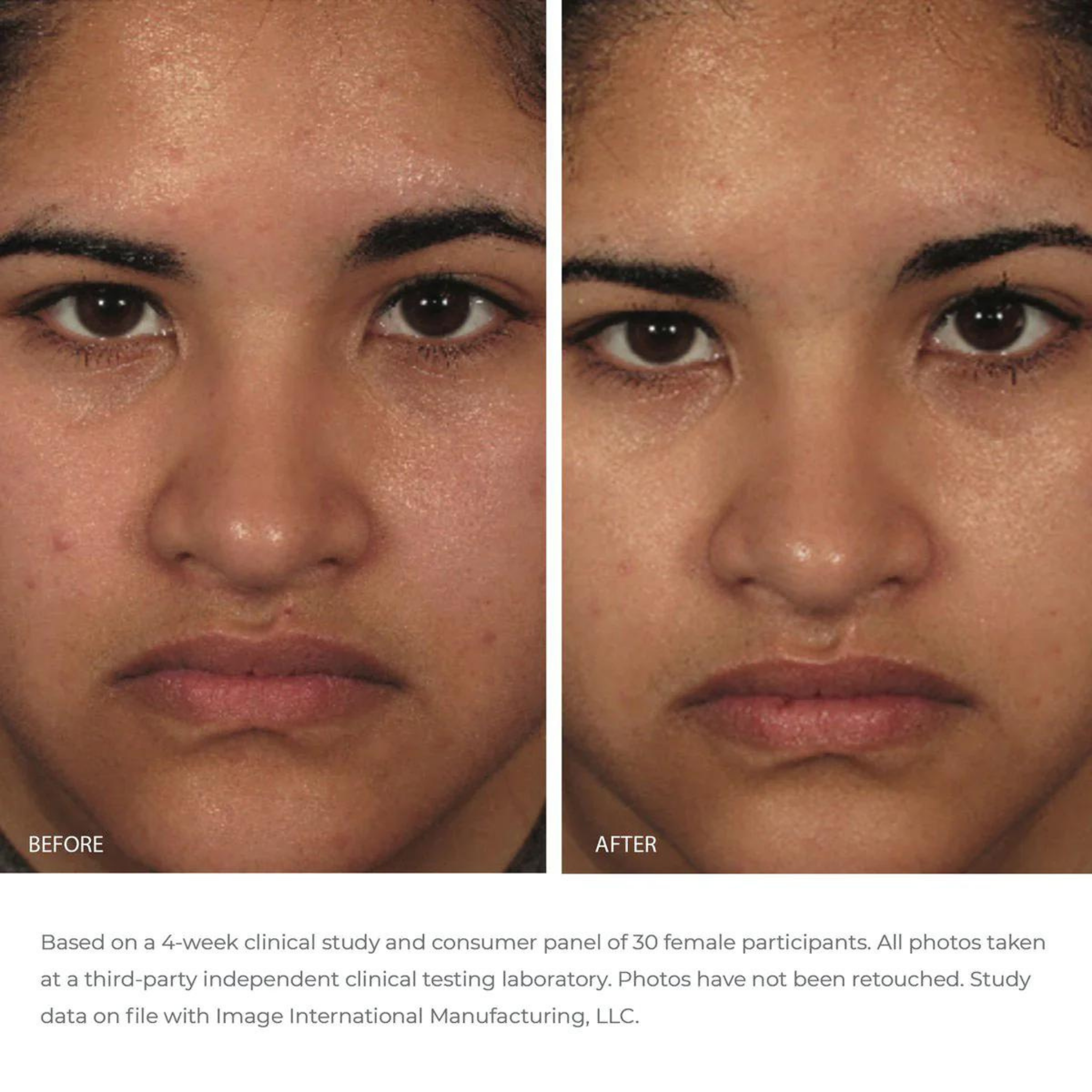 ORMEDIC® Balancing Gel Polisher | IMAGE Skincare